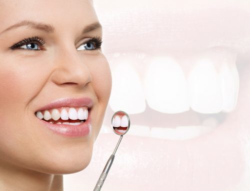 How-often-do-I-need-a-dental-cleaning-500x383.jpg