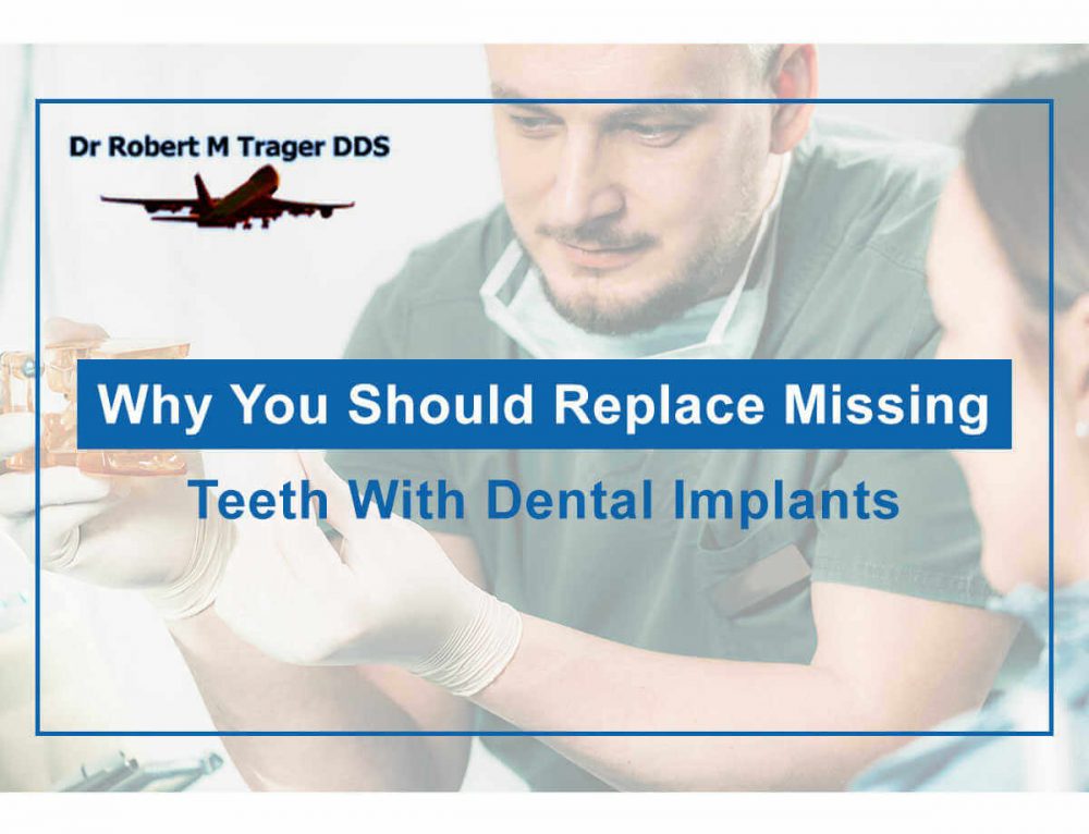 Everything You Need To Know About Dental Implants Robert Trager, DDS
