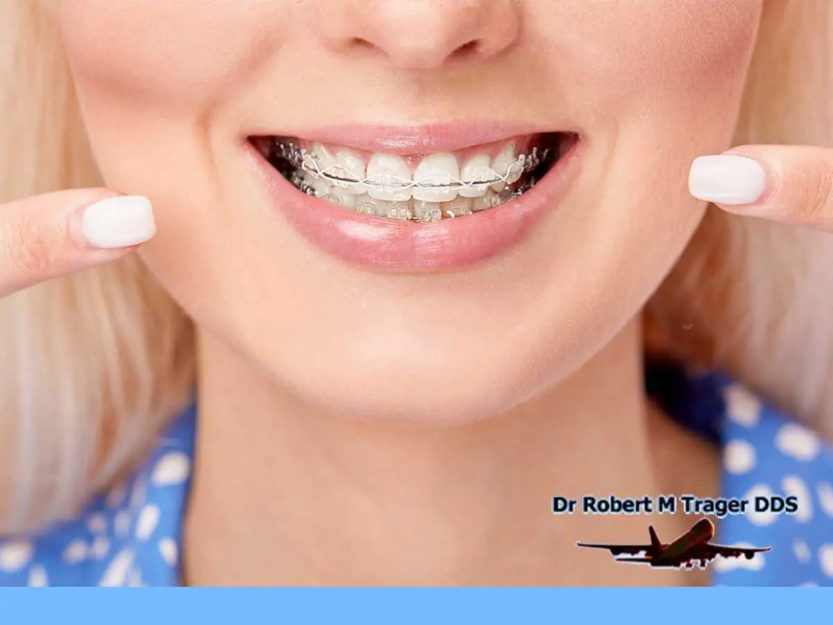 https://jfk-lga-dentist.com/wp-content/uploads/2021/04/advantages-of-ceramic-braces-to-straighten-your-teeth-content-image-ny.jpg.webp